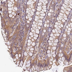 WDR64 Antibody, Novus Biologicals 25 &mu;L, Unlabeled:Antibodies, Polyclonal