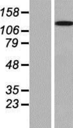 Novus Biologicals™ WDR66 Overexpression Lysate