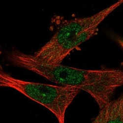 WDR68 Antibody, Novus Biologicals:Antibodies:Primary Antibodies