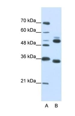 WDR6 Antibody, Novus Biologicals:Antibodies:Primary Antibodies