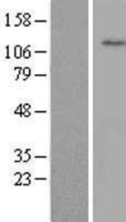 Novus Biologicals&trade;&nbsp;WDR72 Overexpression Lysate