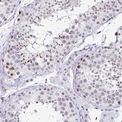WDR72 Antibody, Novus Biologicals:Antibodies:Primary Antibodies