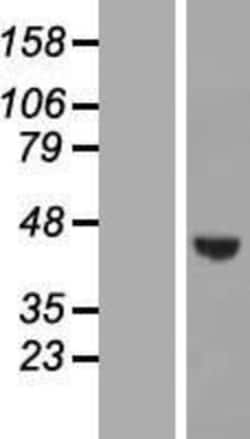 Novus Biologicals™ WDR73 Overexpression Lysate