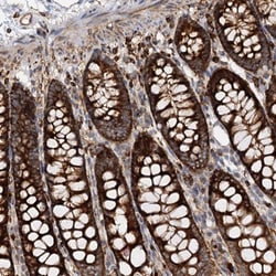WDR73 Antibody, Novus Biologicals 25 &mu;L; Unlabeled:Antibodies, Polyclonal
