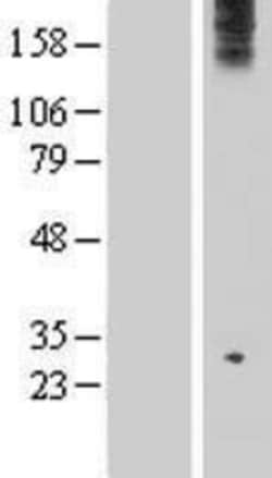 Novus Biologicals&trade;&nbsp;WDR75 Overexpression Lysate