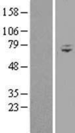 Novus Biologicals™ WDR76 Overexpression Lysate