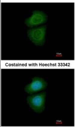 WDR77 Antibody, Novus Biologicals 0.1mL; Unlabeled:Antibodies, Polyclonal