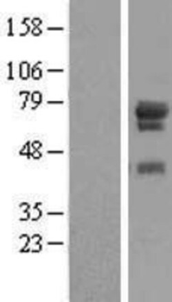 Novus Biologicals&trade;&nbsp;WDR79 Overexpression Lysate