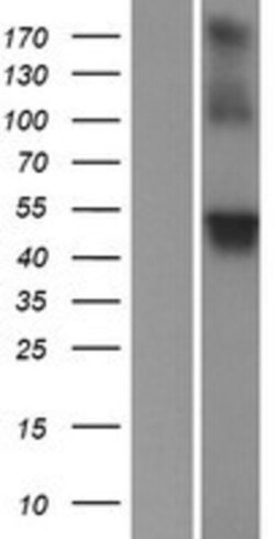 Novus Biologicals™ WDR8 Overexpression Lysate