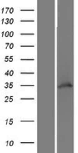 Novus Biologicals™ WDR82 Overexpression Lysate