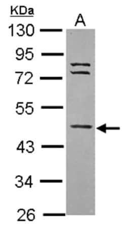 WDR85 Antibody, Novus Biologicals 0.1mL; Unlabeled:Antibodies, Polyclonal