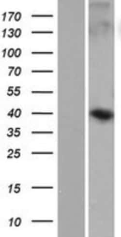 Novus Biologicals&trade;&nbsp;WDR86 Overexpression Lysate