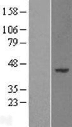 Novus Biologicals™ WDR89 Overexpression Lysate