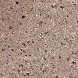 WDR9 Antibody, Novus Biologicals:Antibodies:Primary Antibodies