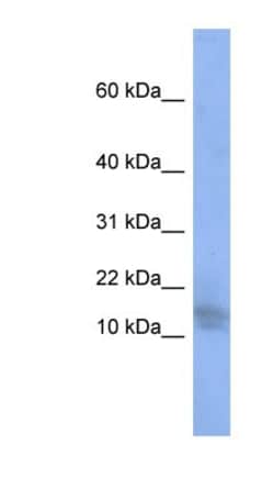 WDR9 Antibody, Novus Biologicals:Antibodies:Primary Antibodies