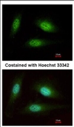 WDR91 Antibody, Novus Biologicals 0.1mL; Unlabeled:Antibodies, Polyclonal