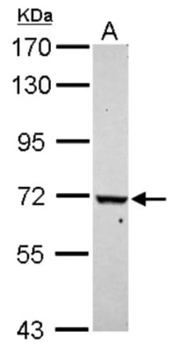 WDR91 Antibody, Novus Biologicals 0.1mL; Unlabeled:Antibodies, Polyclonal