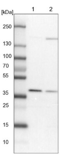 WDR92 Antibody, Novus Biologicals:Antibodies:Primary Antibodies