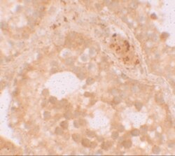 WDR92 Antibody - BSA Free, Novus Biologicals 0.1mg; Unlabeled:Antibodies,
