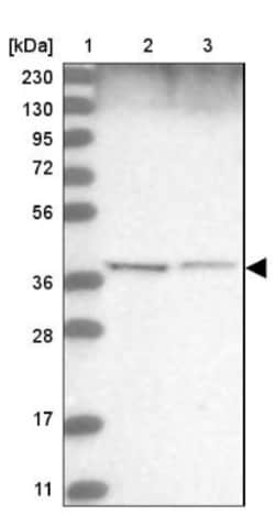 WDR92 Antibody, Novus Biologicals:Antibodies:Primary Antibodies