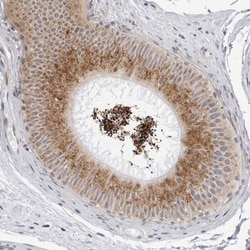 WDTC1 Antibody, Novus Biologicals 0.1mL; Unlabeled:Antibodies, Polyclonal