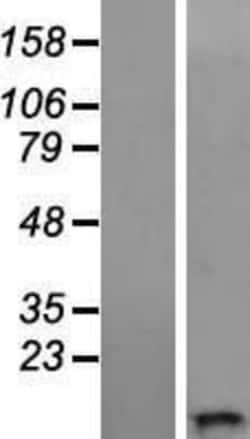 Novus Biologicals&trade;&nbsp;WFDC11 Overexpression Lysate