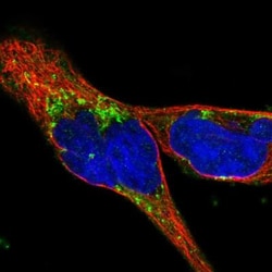 WFDC1 Antibody, Novus Biologicals:Antibodies:Primary Antibodies