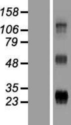 Novus Biologicals&trade;&nbsp;WFDC3 Overexpression Lysate