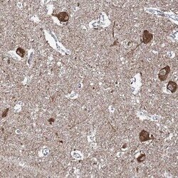 WHAMM Antibody, Novus Biologicals 25 &mu;L; Unlabeled:Antibodies, Polyclonal