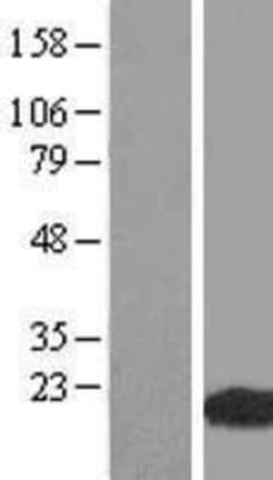 Novus Biologicals™ WHAMML1 Overexpression Lysate