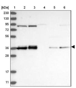WHIP Antibody, Novus Biologicals 0.1mL; Unlabeled:Antibodies, Polyclonal