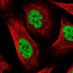 WHIP Antibody, Novus Biologicals 0.1mL; Unlabeled:Antibodies, Polyclonal