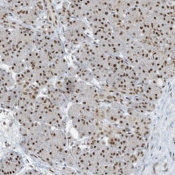 WHIP Antibody, Novus Biologicals 0.1mL; Unlabeled:Antibodies, Polyclonal