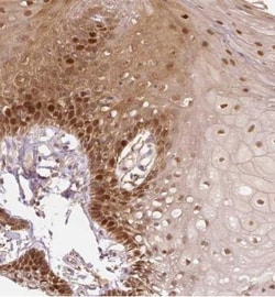WHSC1 Antibody, Novus Biologicals:Antibodies:Primary Antibodies