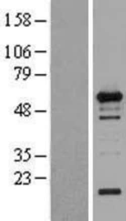 Novus Biologicals™ WIPF1/WIP Overexpression Lysate