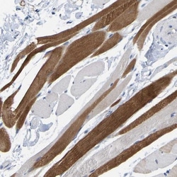 WIPI2 Antibody, Novus Biologicals:Antibodies:Primary Antibodies