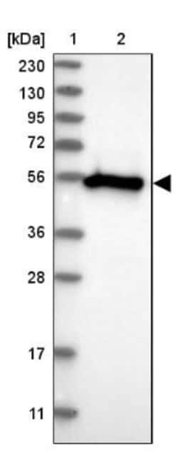 WIRE Antibody, Novus Biologicals:Antibodies:Primary Antibodies