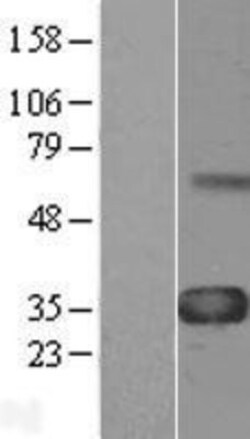 Novus Biologicals&trade;&nbsp;WISP-1/CCN4 Overexpression Lysate