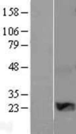 Novus Biologicals™ WISP2 Overexpression Lysate