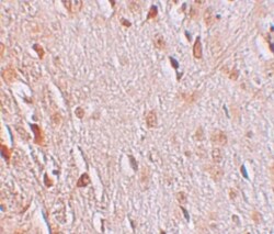 WIZ Antibody - BSA Free, Novus Biologicals 0.1mg; Unlabeled:Antibodies,