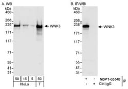 WNK3 Antibody, Novus Biologicals 0.1 mL | Buy Online | Novus Biologicals | Fisher Scientific
