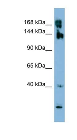 WNK3 Antibody, Novus Biologicals:Antibodies:Primary Antibodies