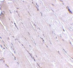 Wnt-10b Antibody - BSA Free, Novus Biologicals 0.1mg; Unlabeled:Antibodies,