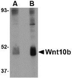Wnt-10b Antibody - BSA Free, Novus Biologicals 0.1mg; Unlabeled:Antibodies,