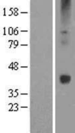 Novus Biologicals&trade;&nbsp;Wnt16 Overexpression Lysate