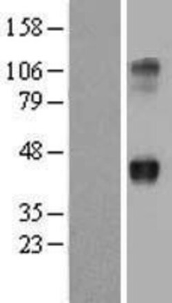 Novus Biologicals™ Wnt-2 Overexpression Lysate
