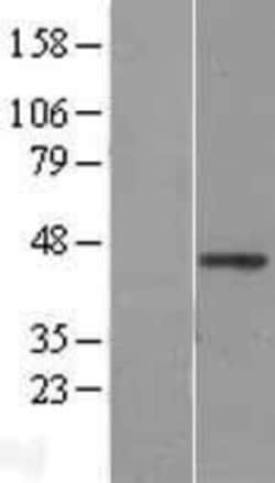 Novus Biologicals&trade;&nbsp;Wnt-2b Overexpression Lysate