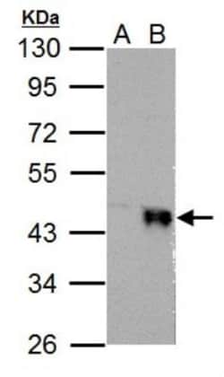 Wnt-4 Antibody, Novus Biologicals 0.1mL; Unlabeled:Antikörper