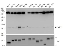 Wnt-4 Antibody, Novus Biologicals 0.1mL; Unlabeled:Antikörper