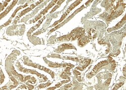 Wnt-5b Antibody - BSA Free, Novus Biologicals 0.025 mg, Unlabeled:Antibodies,